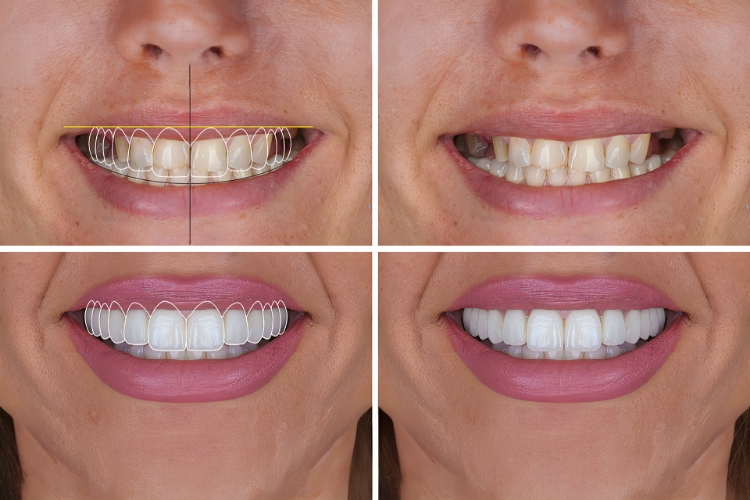Featured image for “Is There a Difference Between Aesthetic Dentistry and Cosmetic Dentistry?”