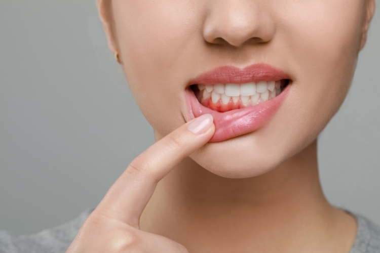 What are the Risk Factors Associated with Poor Hygiene? featured image